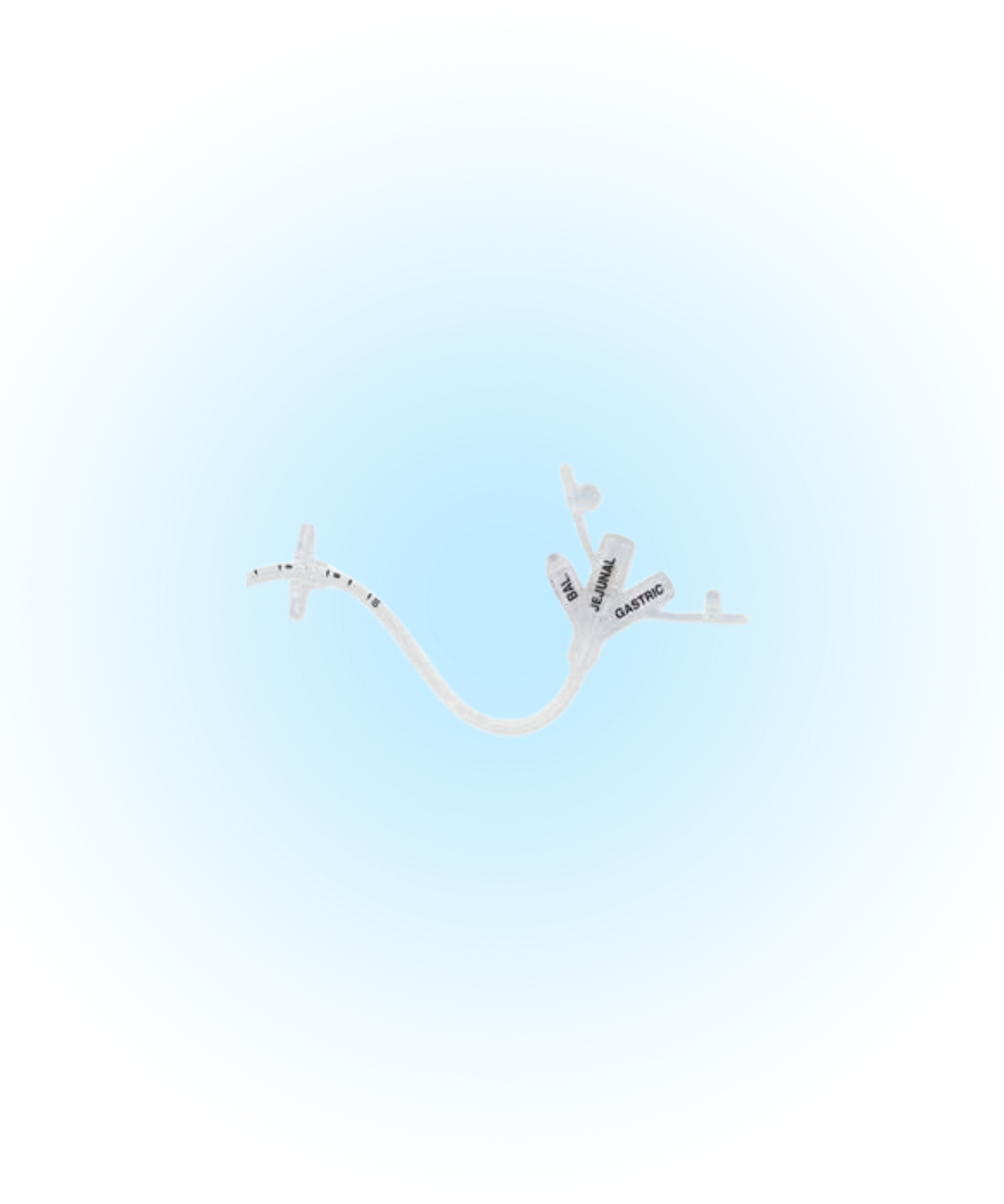 Transgastric Jejunal Feeding Tubes