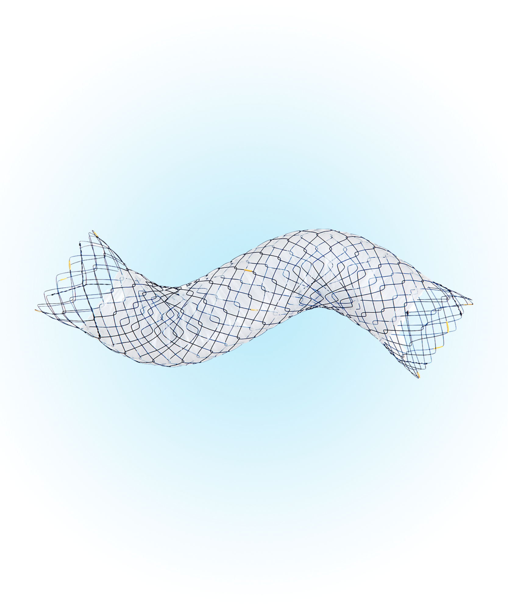Kolonik / Rektum Metal Stent
