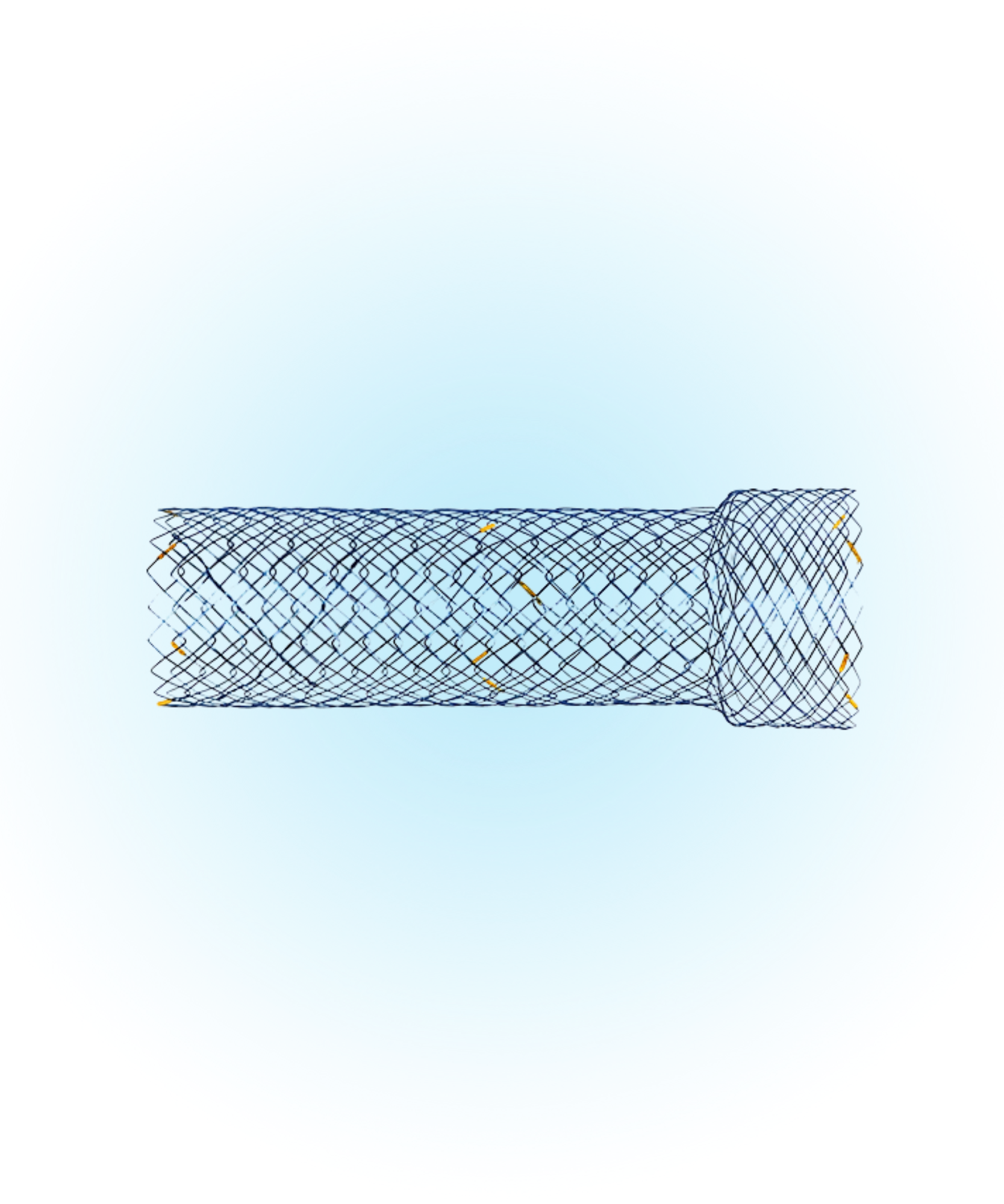 Duodenal / Pilorik Metal Stent