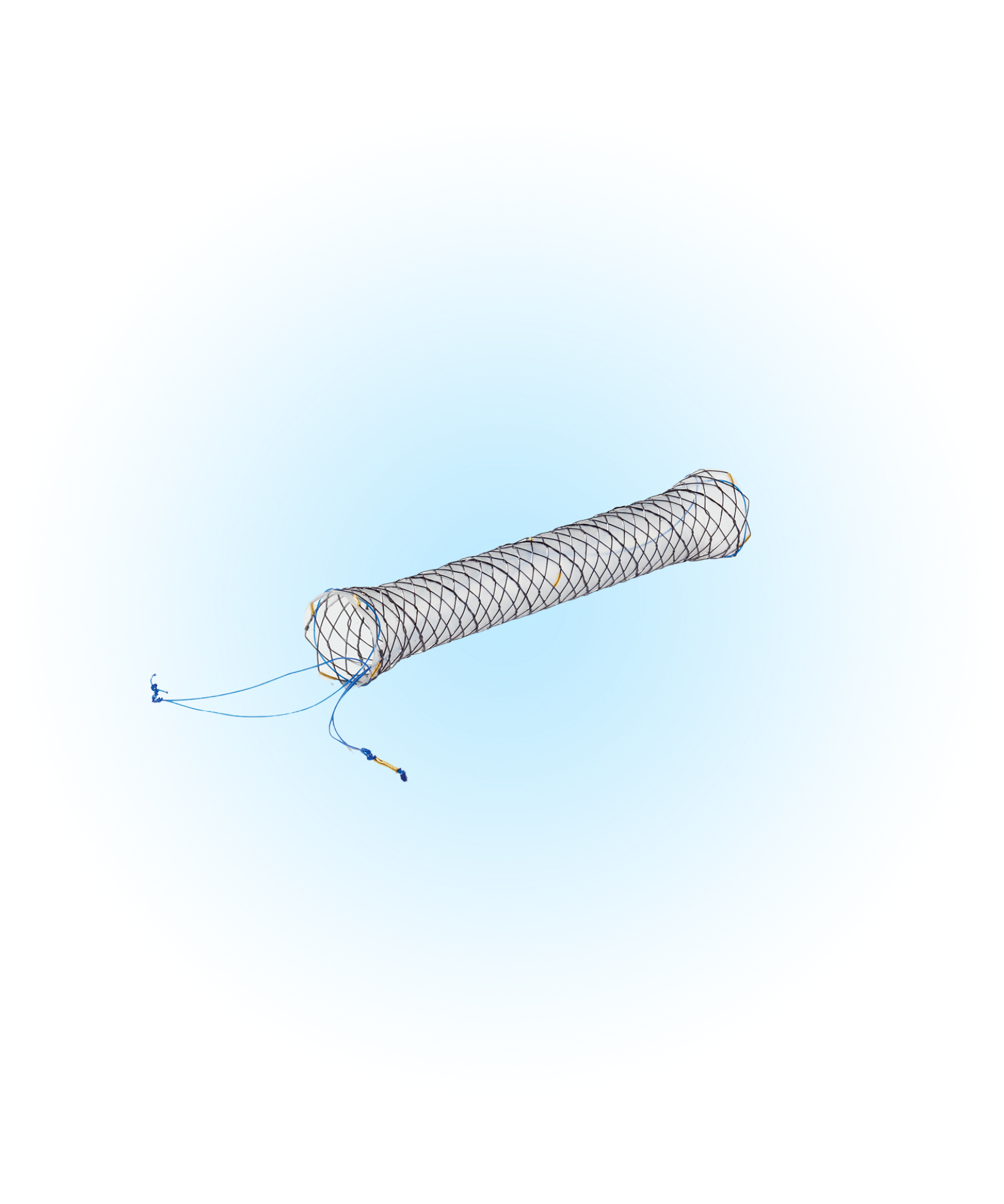 BCB Biliyer Kaplı İpli Stent