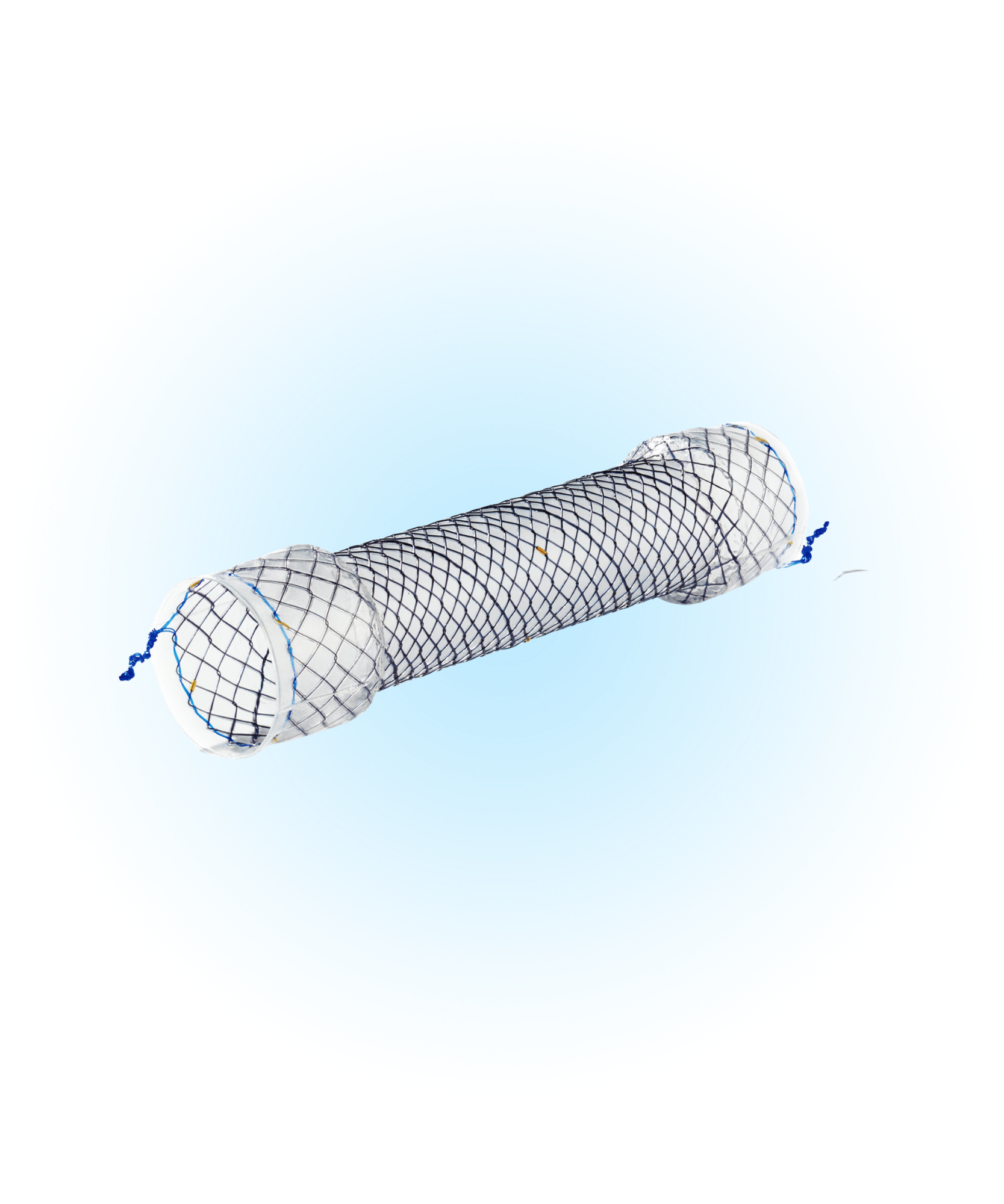 EBN Özefagus Kaplı Stent