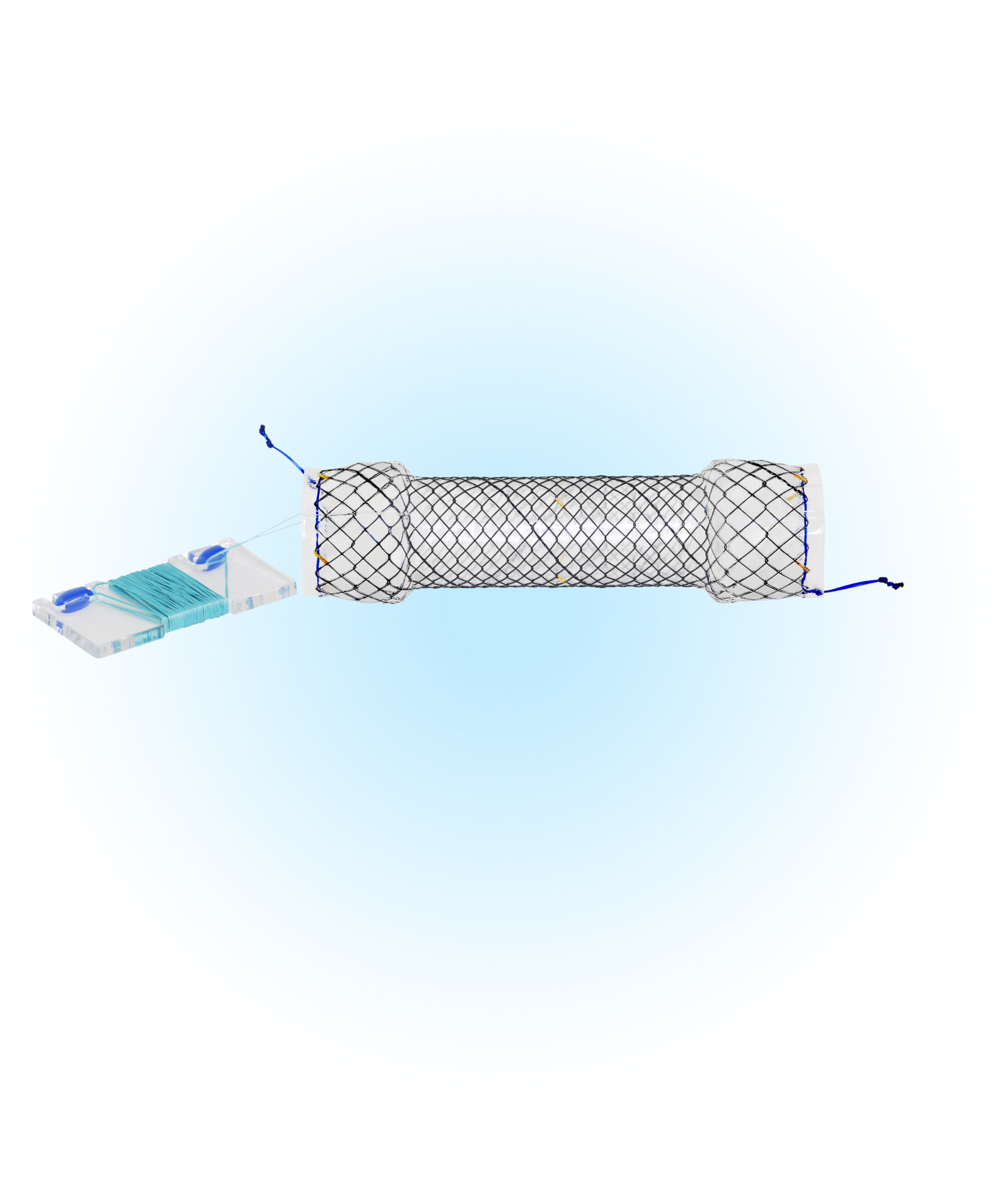 EBNT Özefagus Kaplı İpli Stent