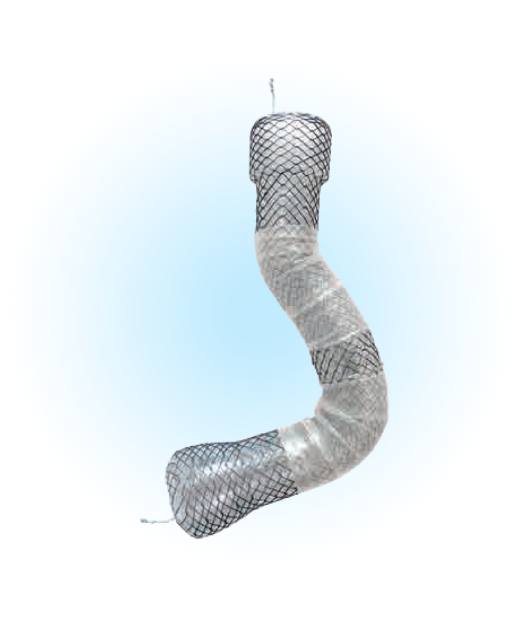 ECBS Özefagus Kaplı Bariatik Stent