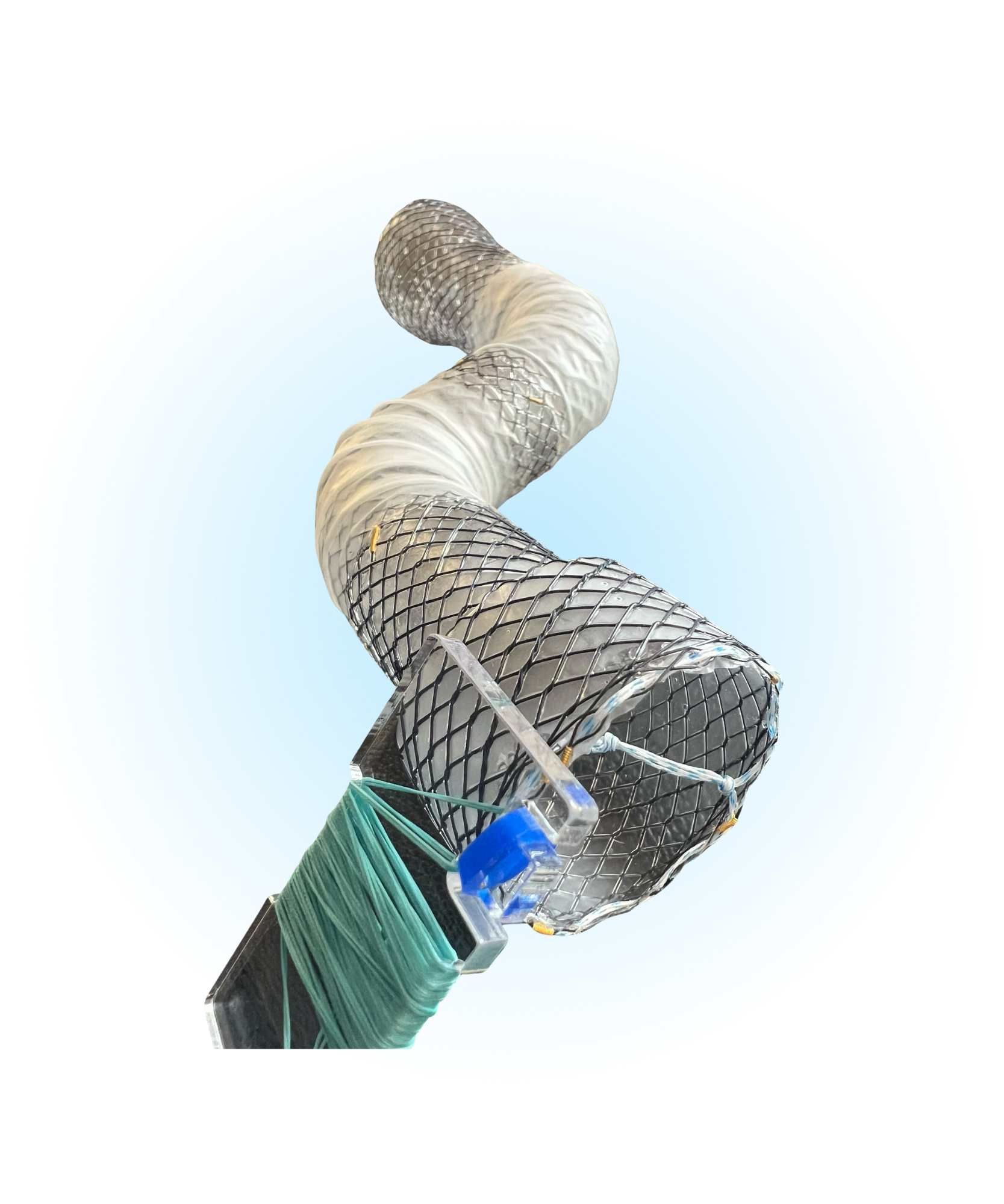 ECBST Özsfagus Kaplı İpli Gastroseal Stent