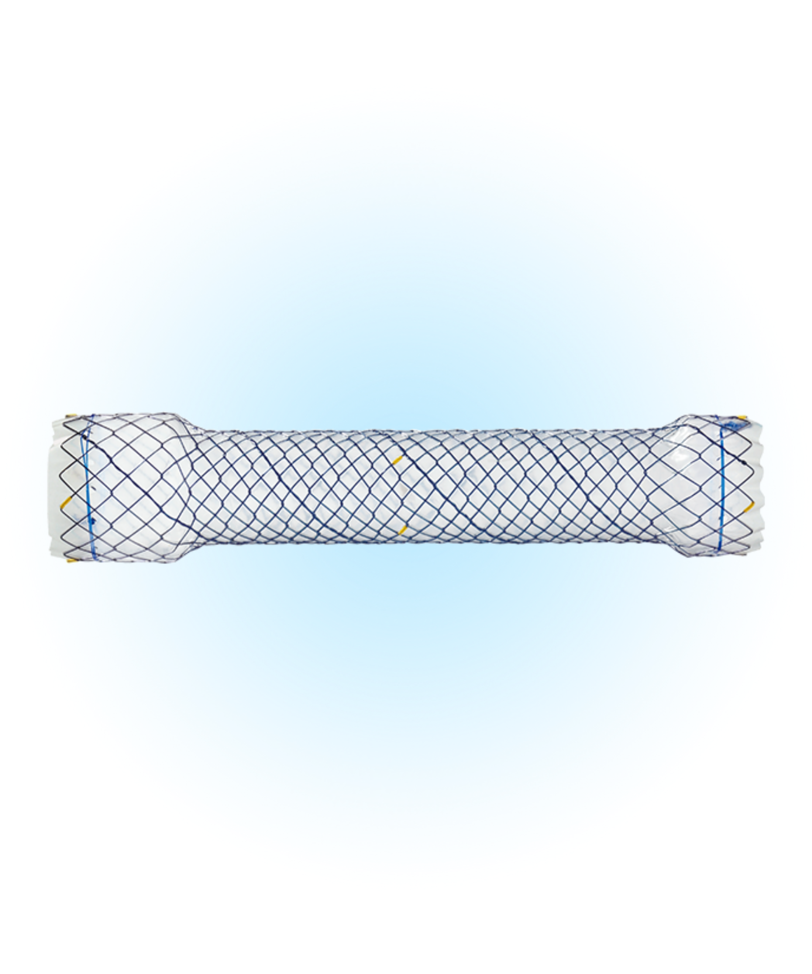 ECN Özefagus Kaplı Stent