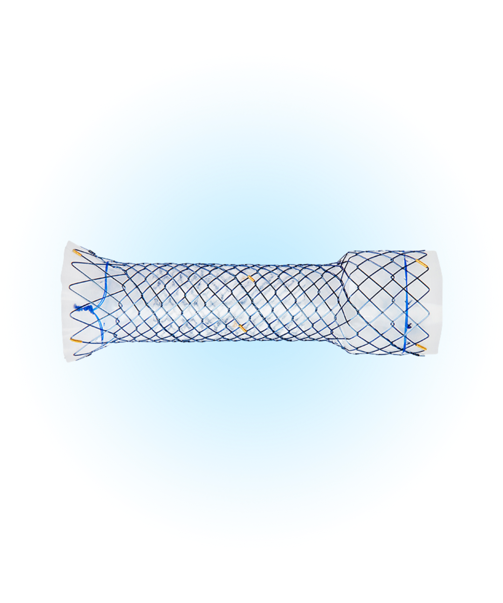 ECP - Özefagus Kaplı Stent