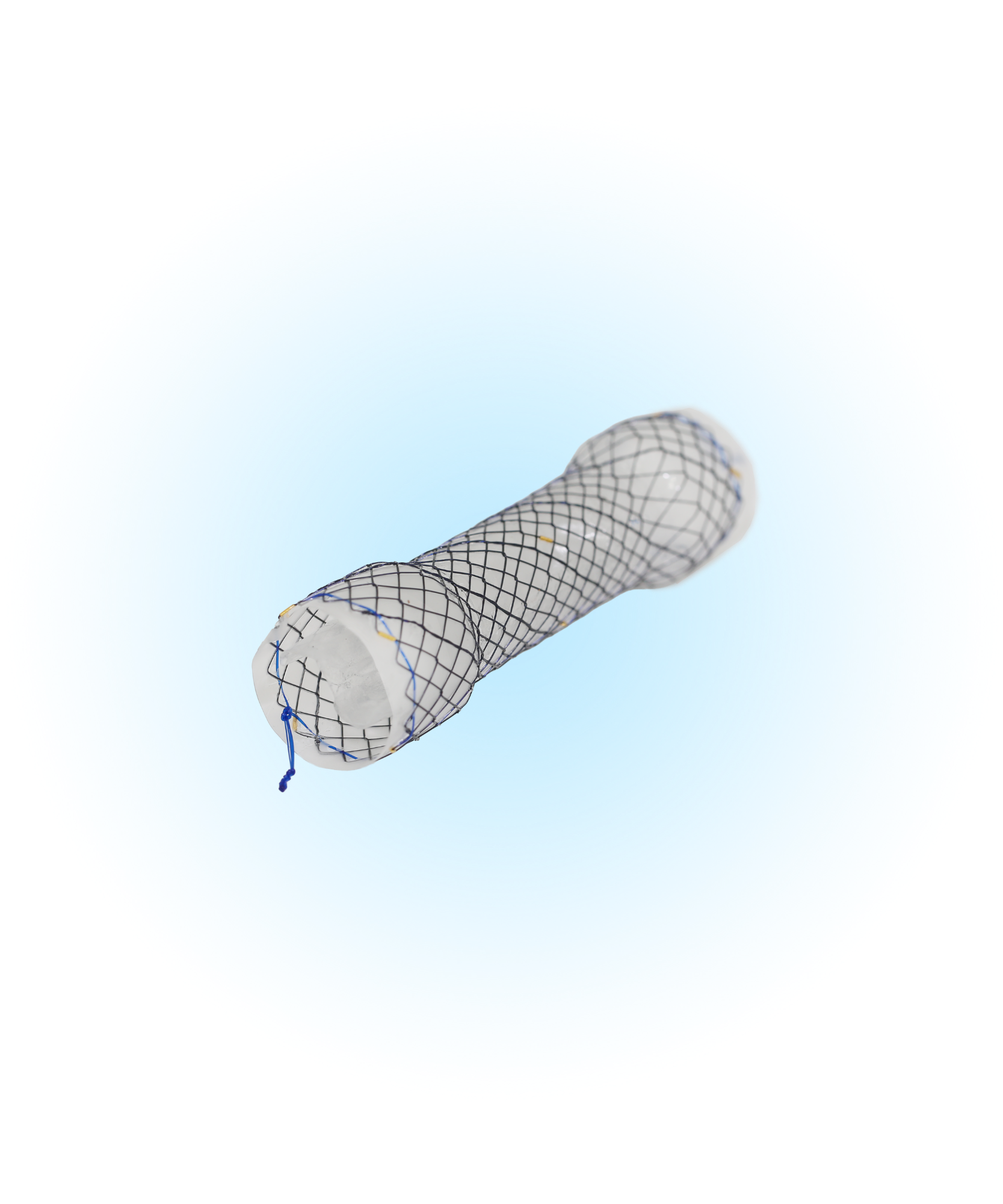 ECW Özefagus Kaplı Anti-Reflü Valfli Stent
