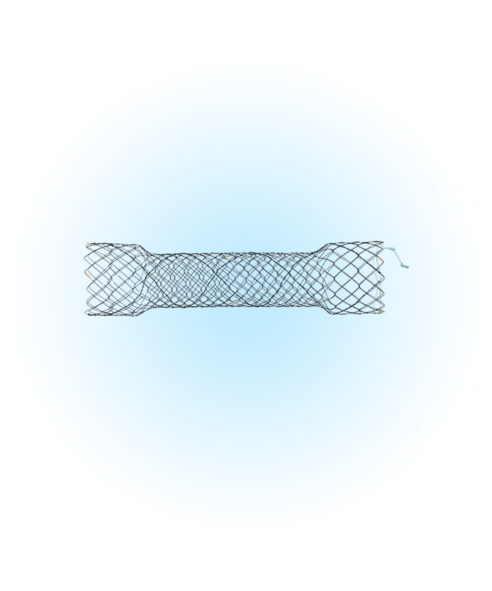 END Özefagus Kapsız İpli Stent