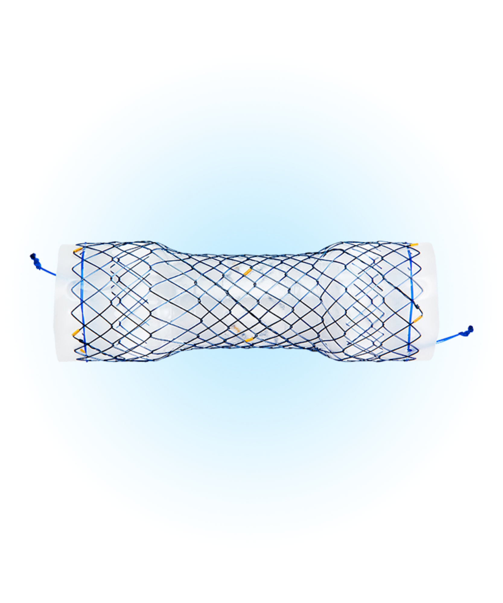 EPB Özefagus Yarı Kaplı Stent