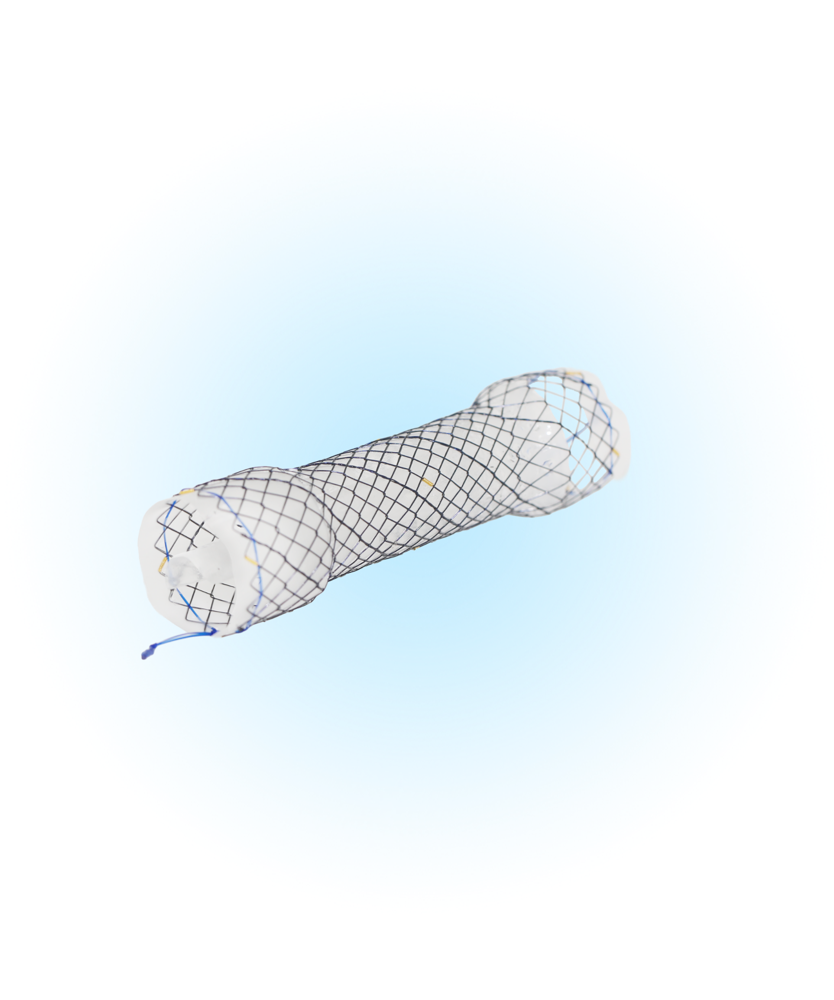 EPV Özefagus Yarı Kaplı Anti-Reflü Valfli Stent