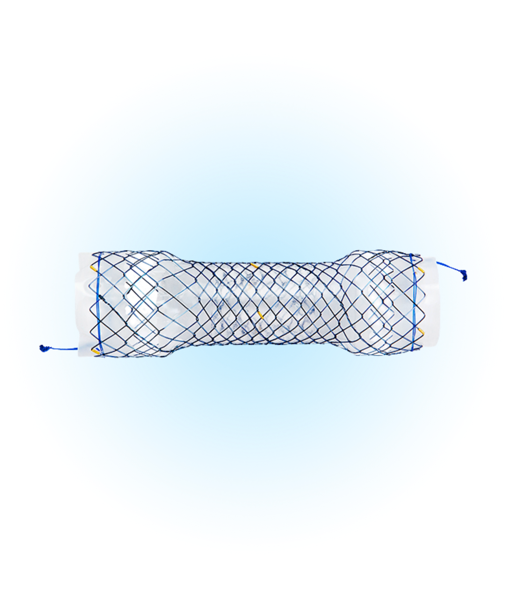 EPW Özefagus Yarı Kaplı Stent
