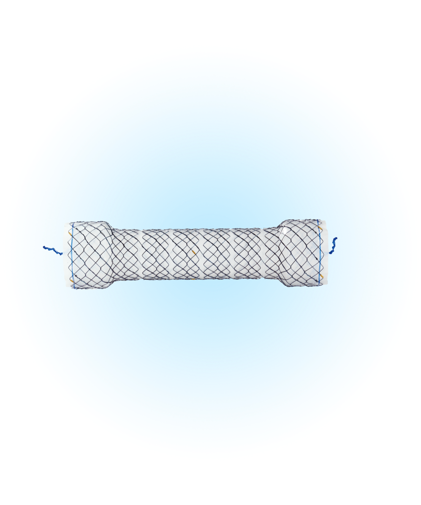 HCC Kolon Kaplı Presitaltik Uyumlu Stent