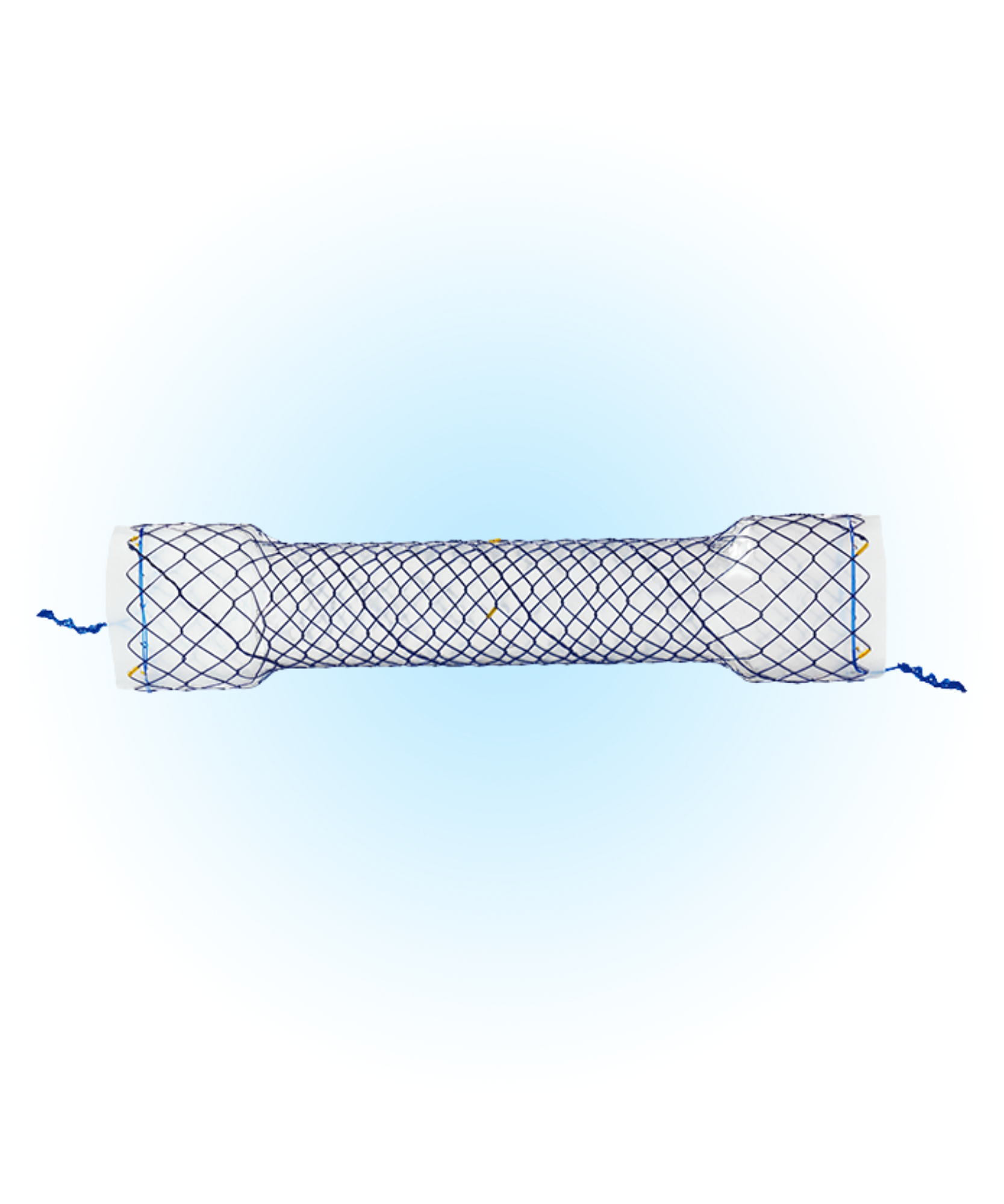 HES Özefagus Kaplı Stent