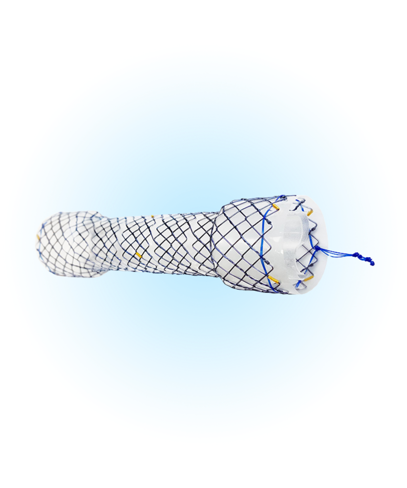 HEV Özefagus Kaplı Peristaltik Uyumlu Anti-Reflü Valfli Stent