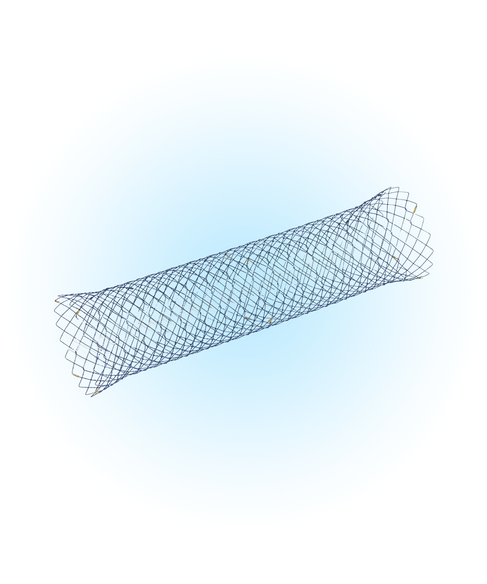 NCS Kolon Kapsız Stent