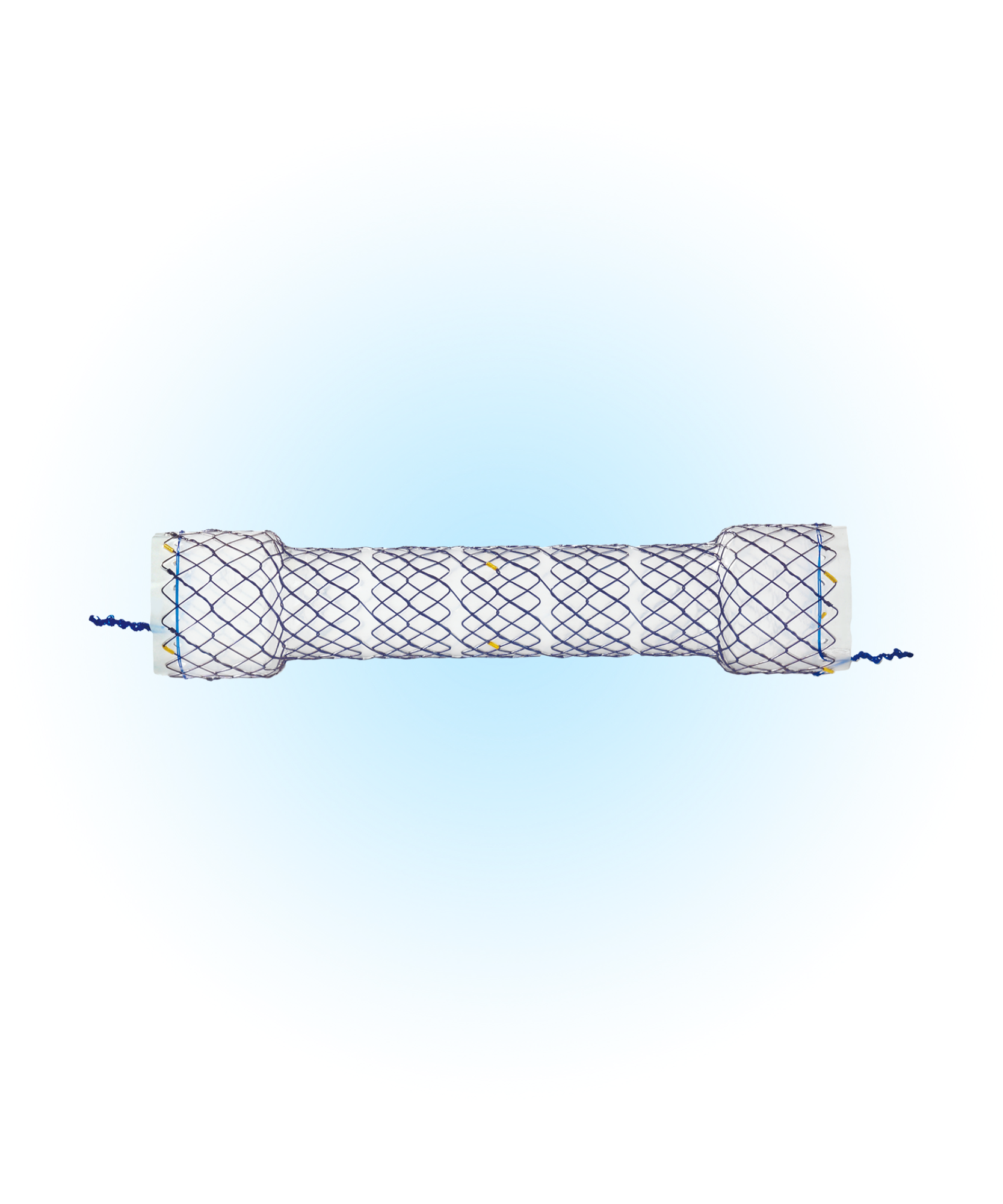 NES Özefagus Kaplı Peristaltik Uyumlu Stent