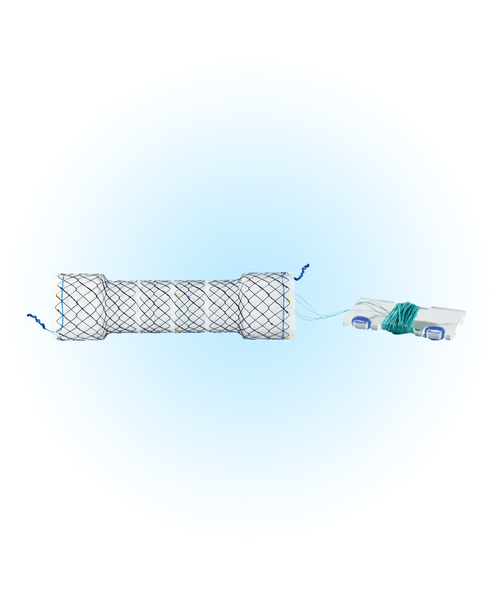 NESCT Özefagus Kaplı Peristaltik Uyumlu İpli Stent