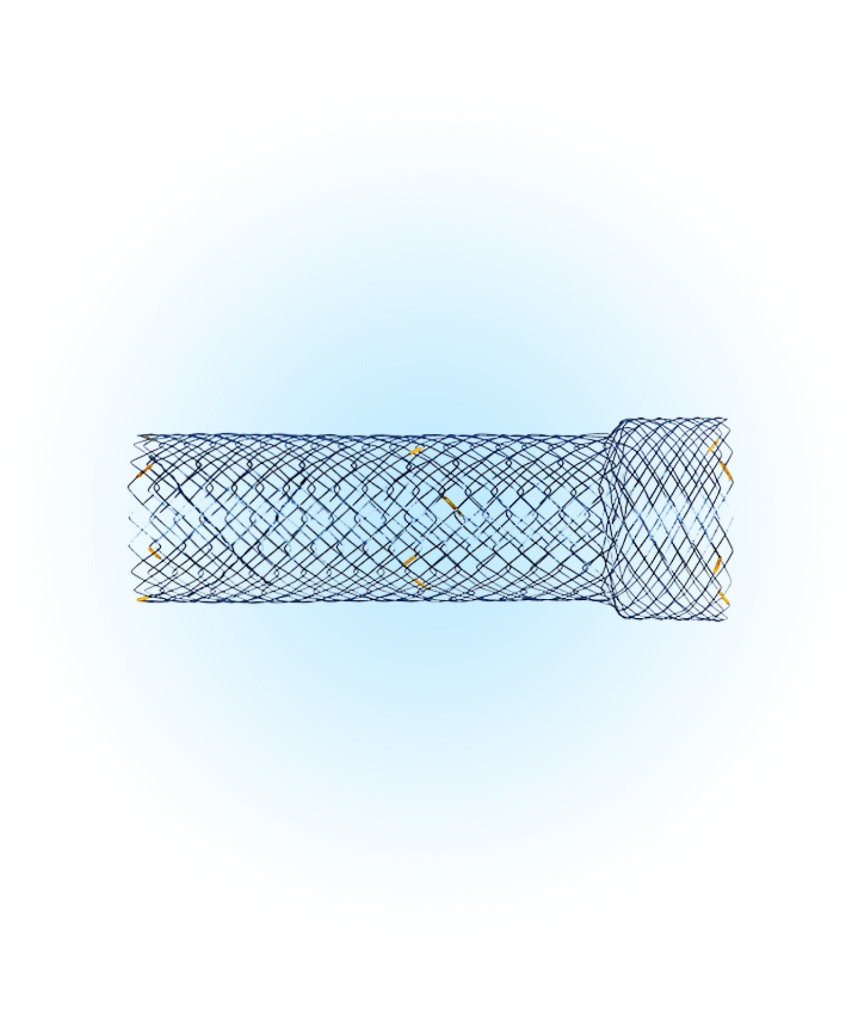 DNJF Duodenum Kapsız Stent