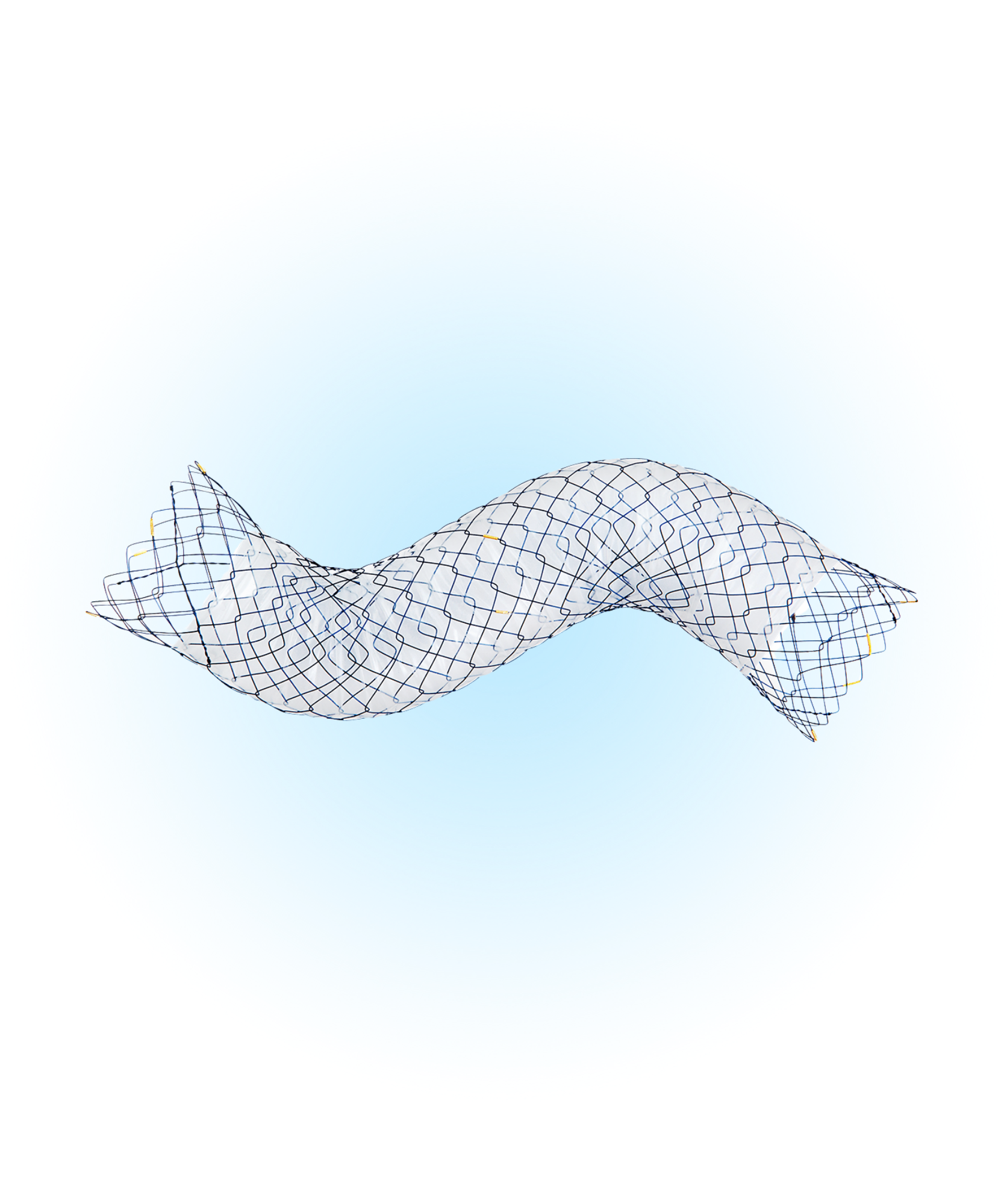 TLD Duodenum Yarı Kaplı Stent
