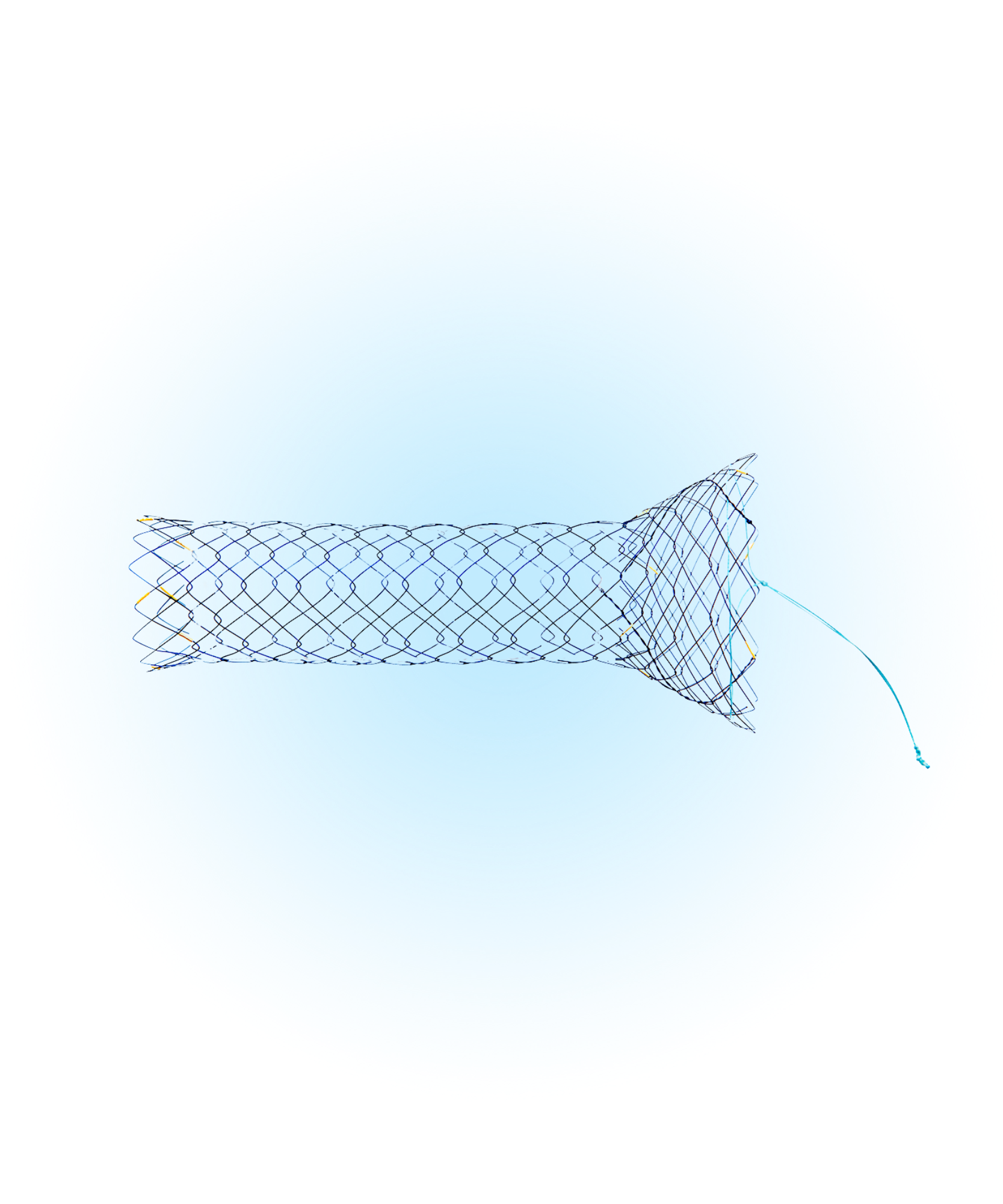 DPDL Duodenum Yarı Kaplı Çanak Stent 