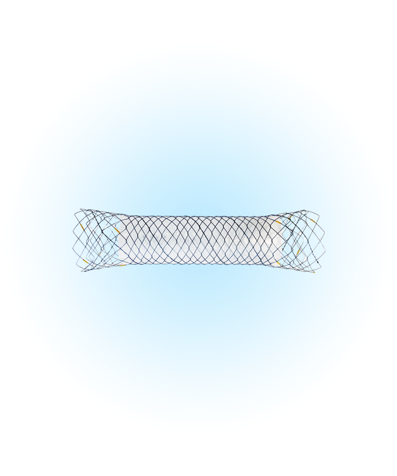 NDC Duodenum Yarı Kaplı Stent