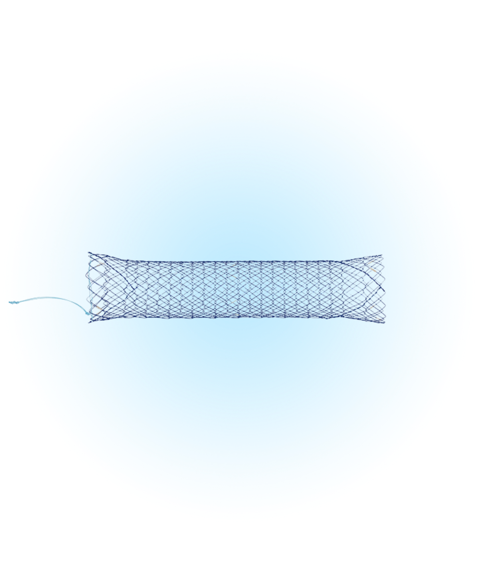 NDSL Duodenum Kapsız İpli Stent