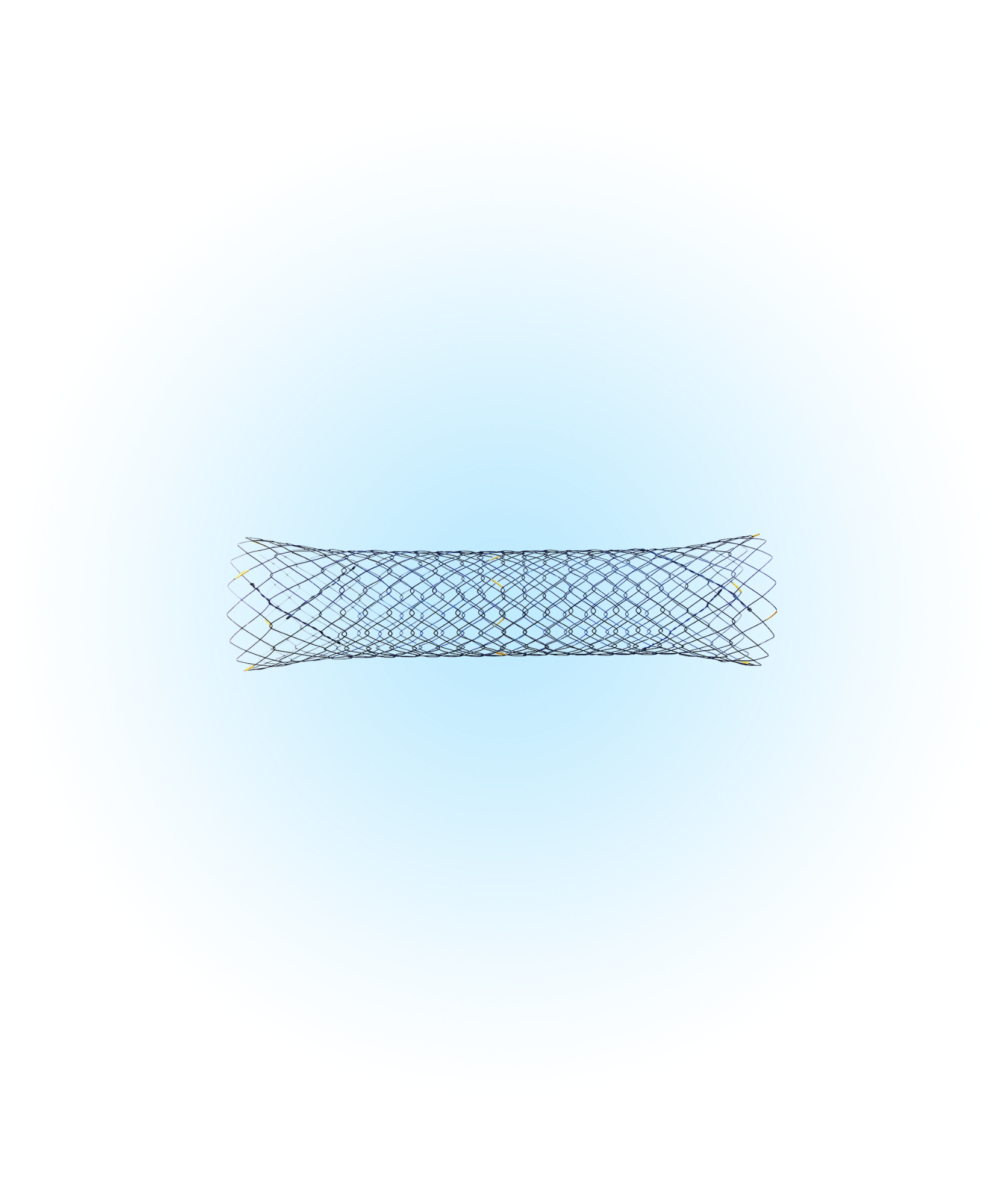 NDS Duedonum Kapsız Stent