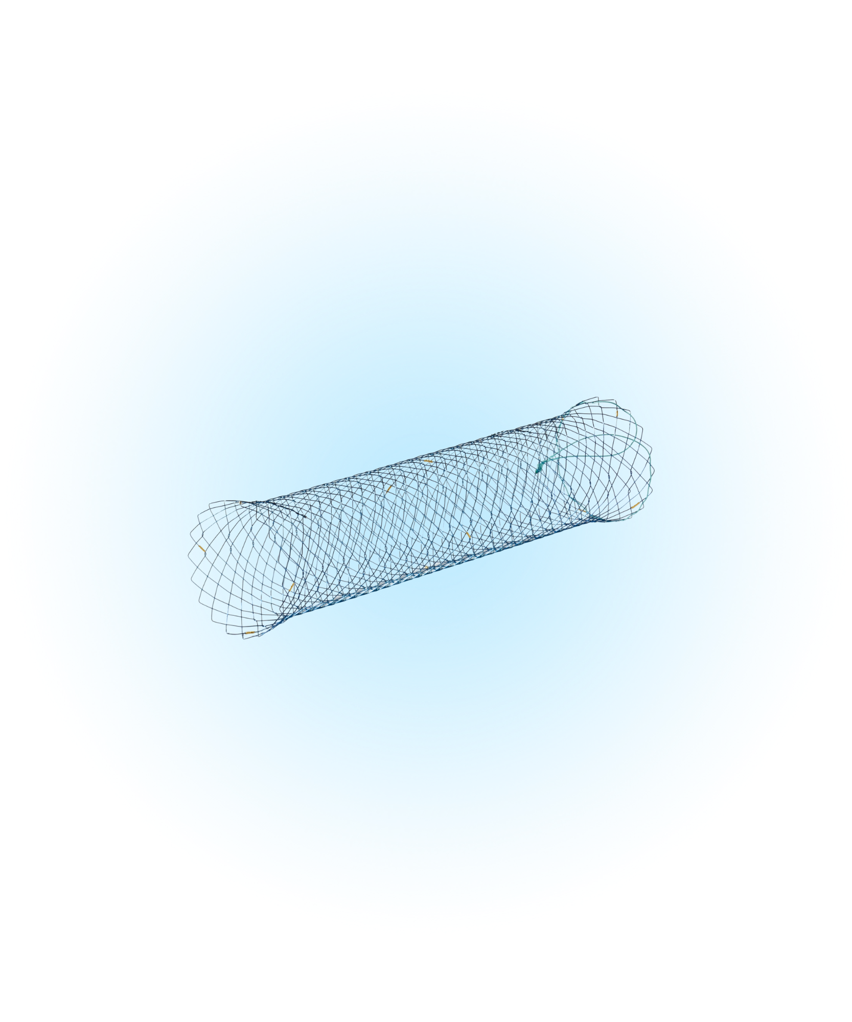 NCSL Kolon Kapsız İpli Stent